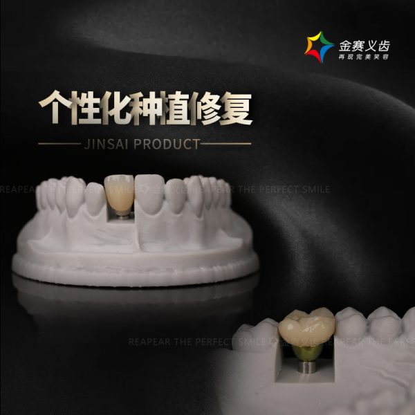 个性化种植修复